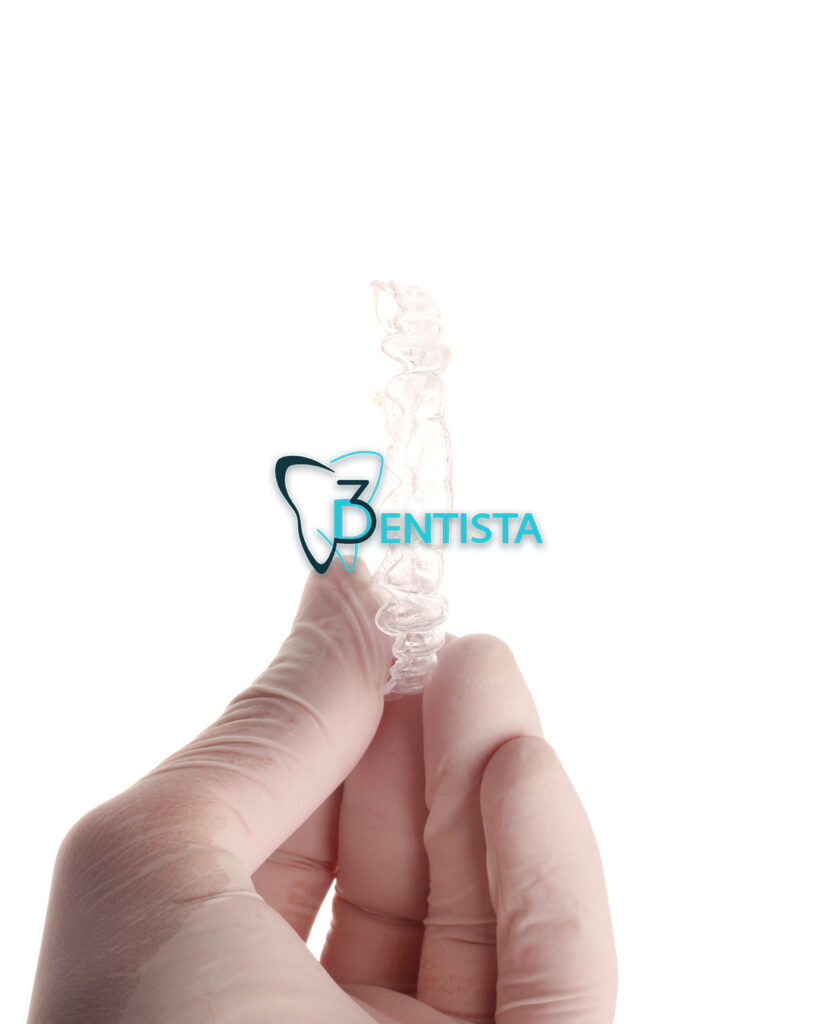 kucno beljenje, izbeljivanje zuba